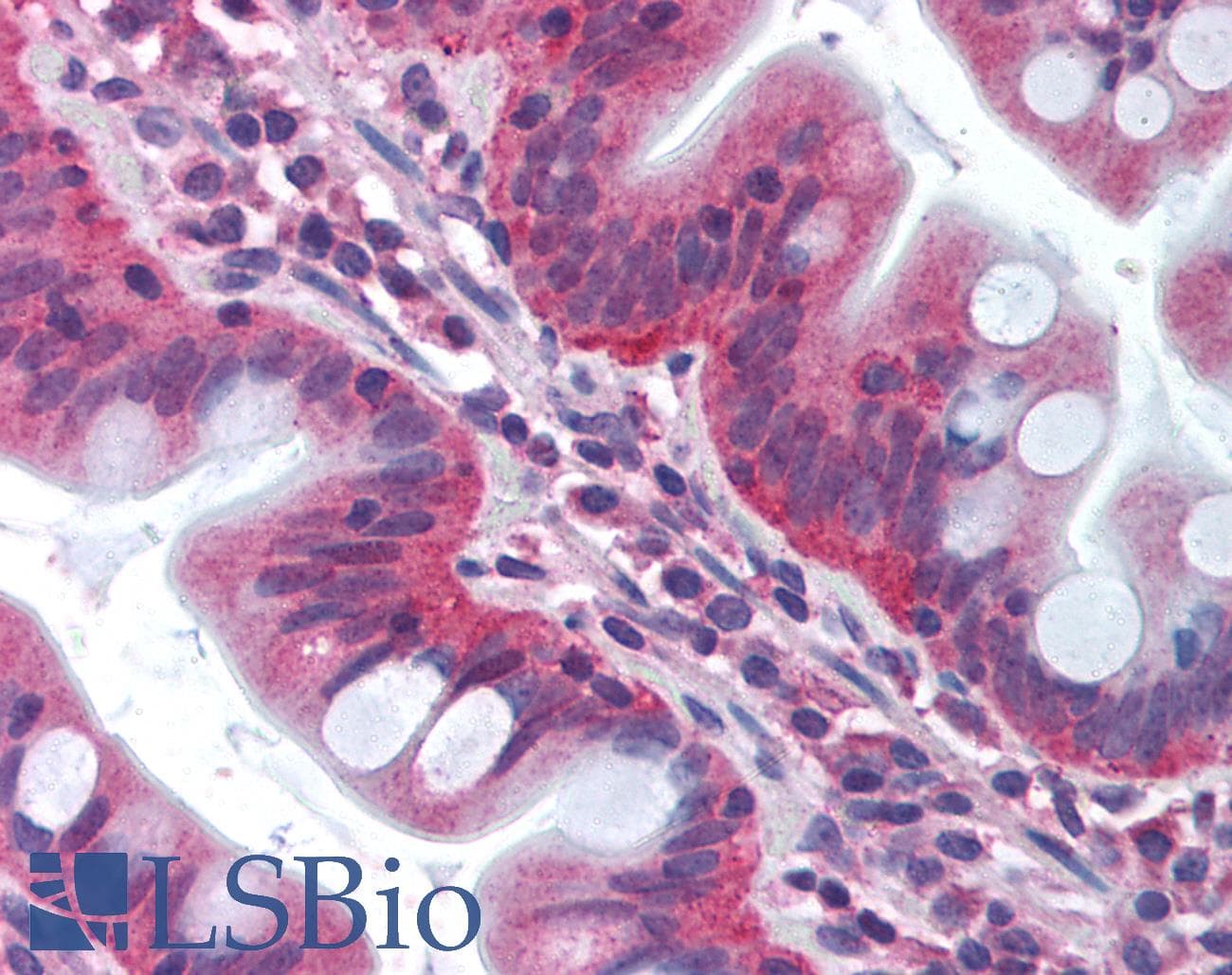 IHC-plus™ TRAF3IP2 / ACT1 Antibody