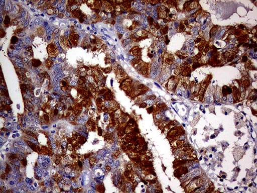 p16INK4a / CDKN2A Antibody (clone OTI11E9)