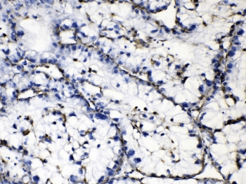 GAA / Alpha-Glucosidase, Acid Antibody