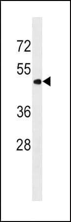 PNPLA3 / Adiponutrin Antibody (aa109-137)