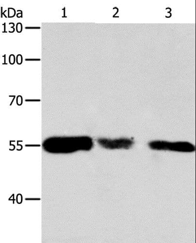 CALR / Calreticulin Antibody