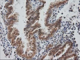Monoclonal Mouse anti-Human MGLL / Monoacylglycerol Lipase Antibody (clone OTI1H1, IHC, IF, WB)