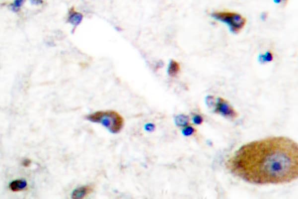 Polyclonal Rabbit anti-Human GRM6 / MGLUR6 Antibody (Ala865, IHC, WB)