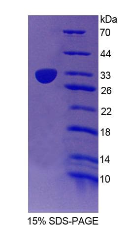 Human CUL1 / Cullin 1 Protein (Recombinant His-T7)