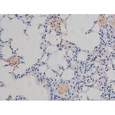 Polyclonal Rabbit anti-Human CHUK / IKKA / IKK Alpha Antibody (phospho-Ser180,phospho-Ser181, IHC, IF, WB)