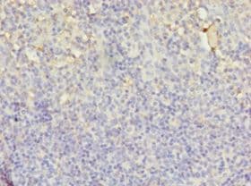 LYZ / Lysozyme Antibody (aa19-148)