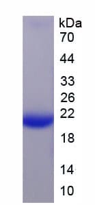 Rat CALM1 / Calmodulin Protein (Recombinant His)