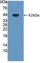 CDH3 / P-Cadherin Antibody (aa371-660, PE)