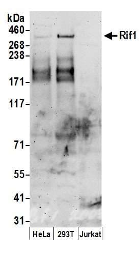 IHC-plus™ RIF1 Antibody (aa2425-C-term)