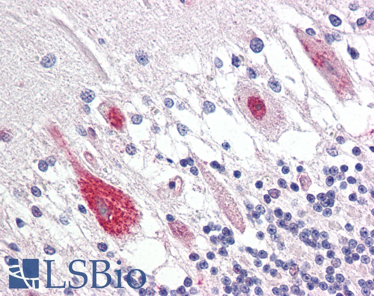 IHC-plus™ GUCY1B3 Antibody (aa10-59)