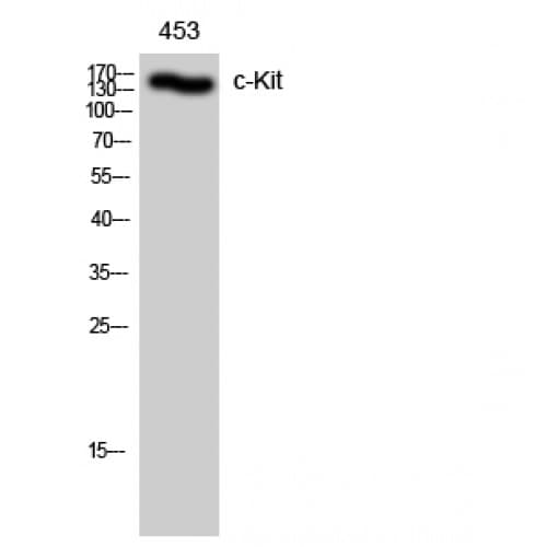 Polyclonal Rabbit anti-Human c-Kit / CD117 Antibody (880-960 aa, IHC, WB)