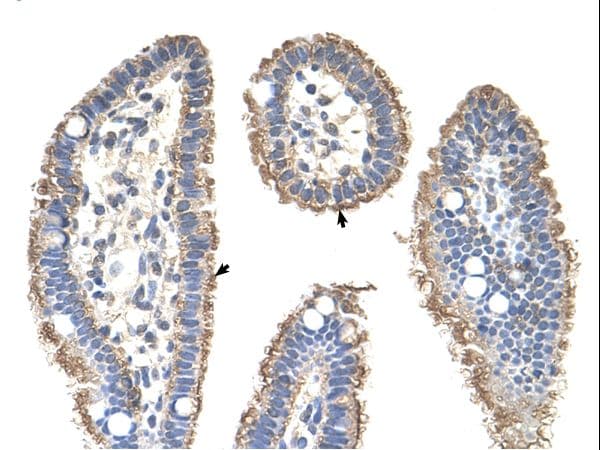 KRT2 / CK2 / Cytokeratin 2 Antibody (aa351-400, FITC)