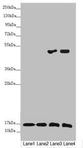 NDUFS6 Antibody