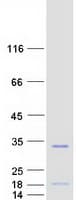 Human CT45A5 Protein (Recombinant Myc-DDK (Flag))