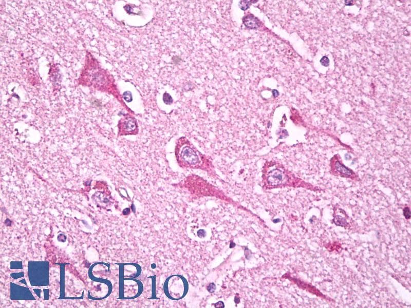 IHC-plus™ NDUFS7 Antibody (aa58-68)