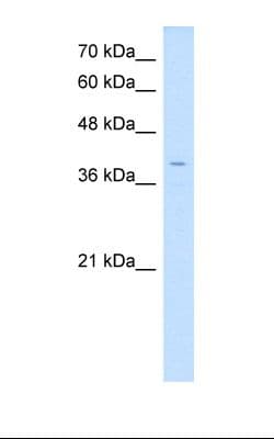 LSAMP / LAMP Antibody (N-Terminus, Biotin)
