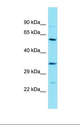 CSRNP2 / FAM130A1 Antibody (aa467-516)