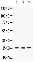 CACYBP Antibody