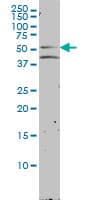 NR1H2 / LXR Beta Antibody (clone 2H2-H3)