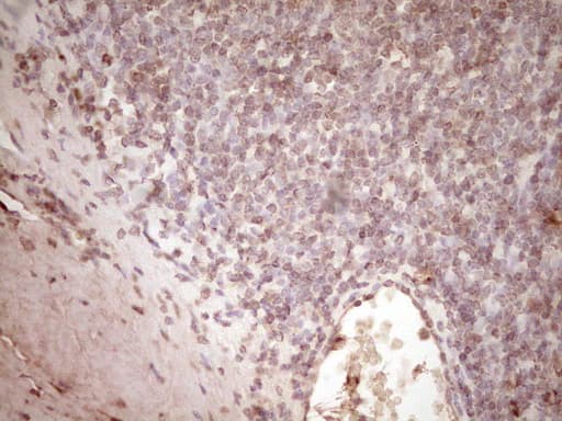 PLAT / TPA Antibody (aa157-426, clone OTI3H3)