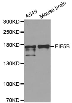 Polyclonal Rabbit anti-Human EIF5B / IF2 Antibody (IHC, IF, WB)