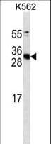 Monoclonal Mouse anti-Human APCS / Serum Amyloid P / SAP Antibody (WB)
