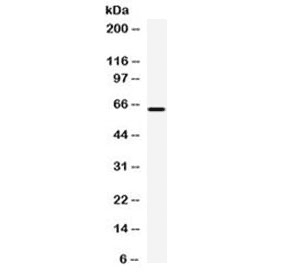 CPM / Carboxypeptidase M Antibody