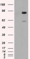 GBE1 Antibody (clone OTI4D9)
