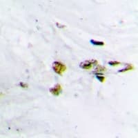 CAMK2A / CaMKII Alpha Antibody