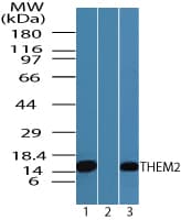 IHC-plus™ ACOT13 / THEM2 Antibody (aa100-150)