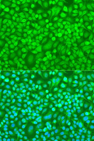 CASP8 / Caspase 8 Antibody