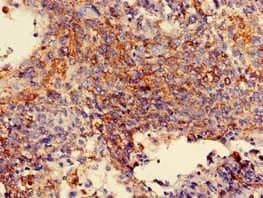 MAN2A1 / Mannosidase II Antibody