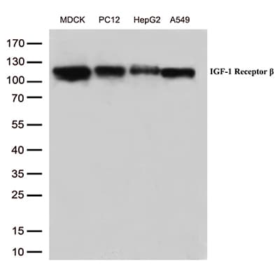 IGF1R / IGF1 Receptor Antibody (aa741-935, clone OTI11E4)