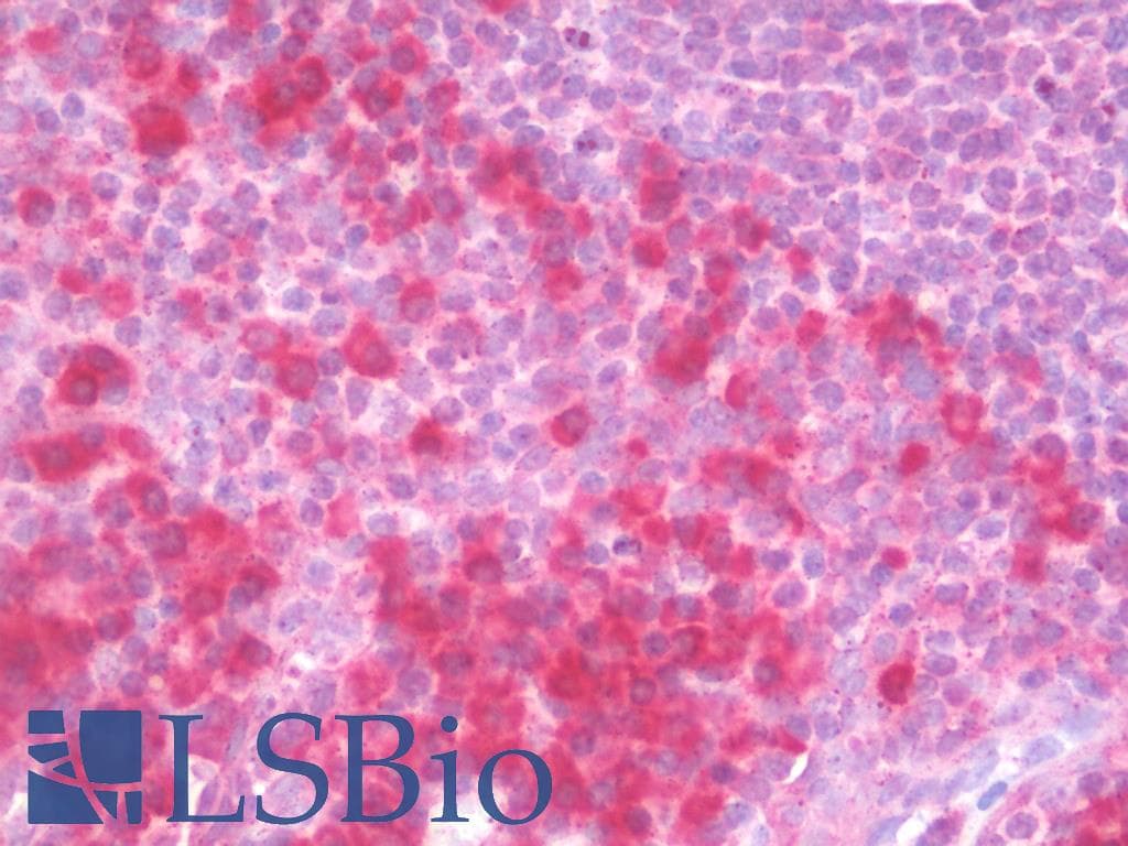 IHC-plus™ Polyclonal Rabbit anti-Human CRTC2 / TORC2 Antibody (IHC, IF, WB)