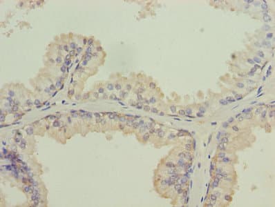 ISA2 / ISCA2 Antibody