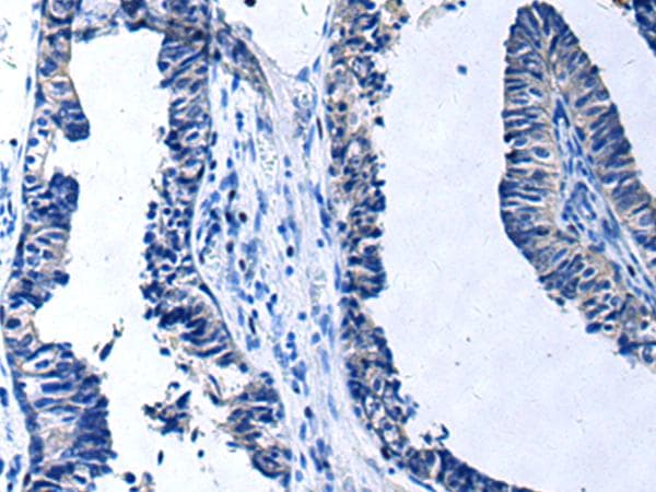Polyclonal Rabbit anti-Human PROC / Protein C Antibody (IHC)
