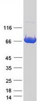 Human CEP76 Protein (Recombinant Myc-DDK (Flag))