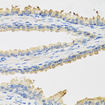 Leptin Antibody