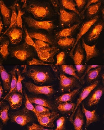 DNM1L / DRP1 Antibody
