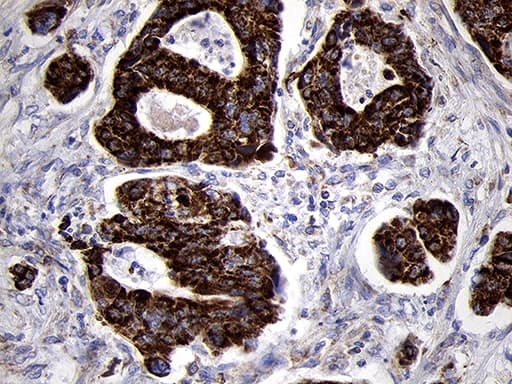 TIMM8A Antibody (clone OTI5C8)