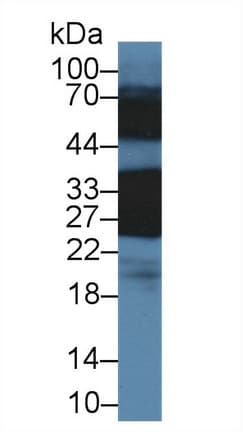 CRYBB1 Antibody (aa6-186, Biotin)