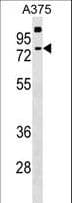 Polyclonal Rabbit anti-Human TKTL2 Antibody (aa43-71, WB)