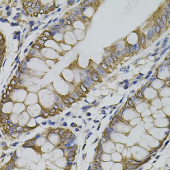 ARHGEF11 Antibody