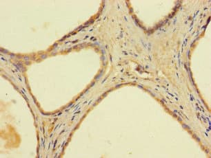 Polyclonal Rabbit anti-Human AADAC Antibody (IHC)