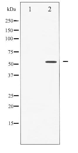 CASP8 / Caspase 8 Antibody (phospho-Ser347)