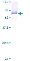 Human GAK Protein (Recombinant GST)