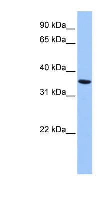 Polyclonal Rabbit anti-Human ANXA8L1 Antibody (aa216-265, WB)