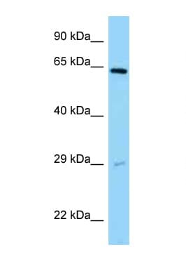 Polyclonal Rabbit anti-Human SNX11 Antibody (aa90-139, WB)