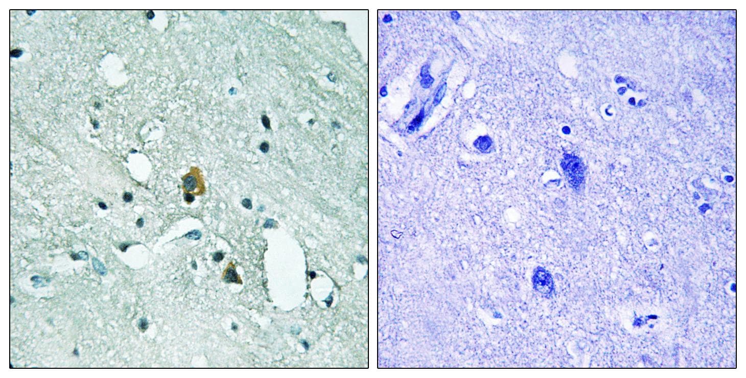 Polyclonal Rabbit anti-Human IP3R Antibody (phospho-Ser1764, IHC)