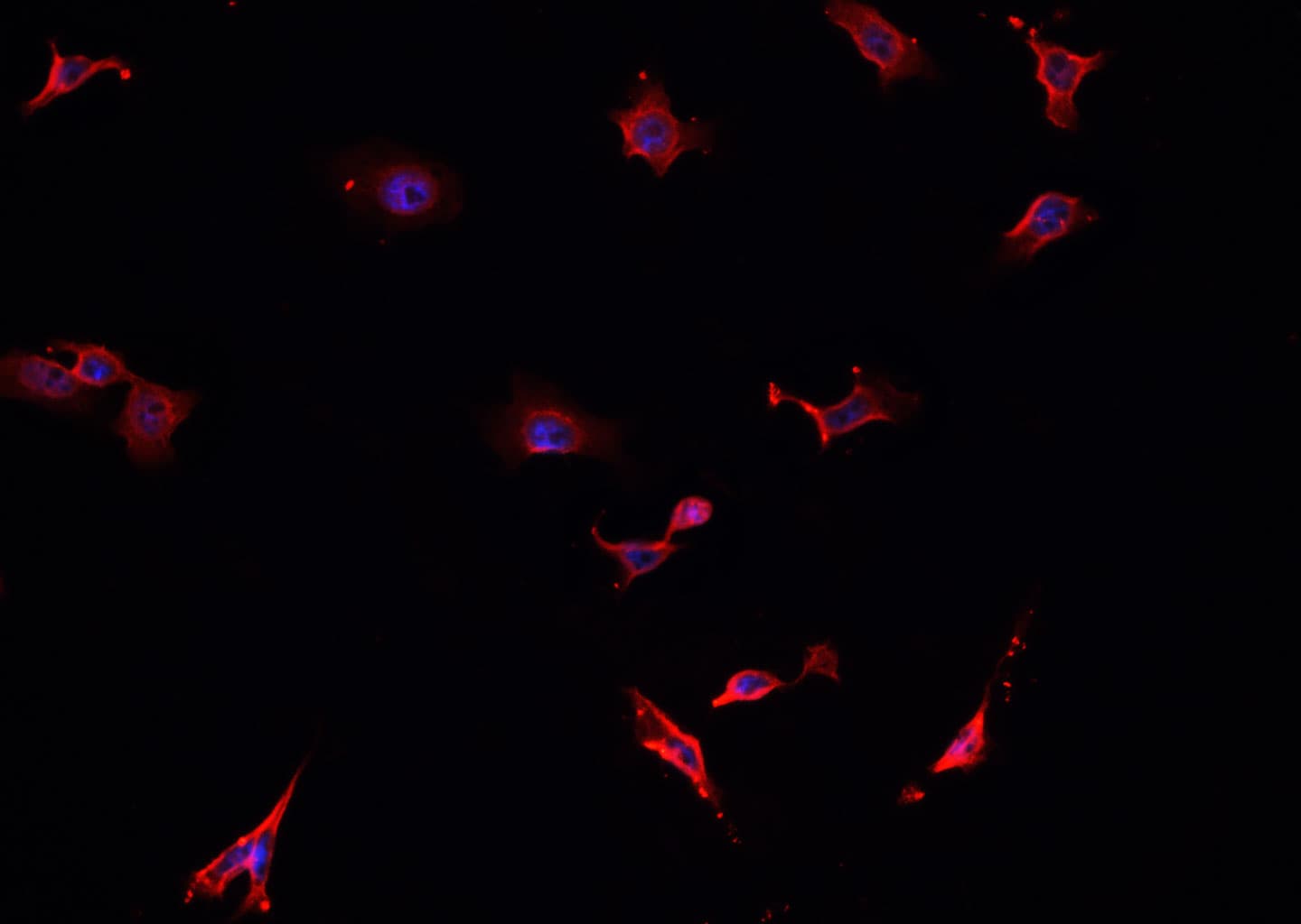 TAC1 Antibody
